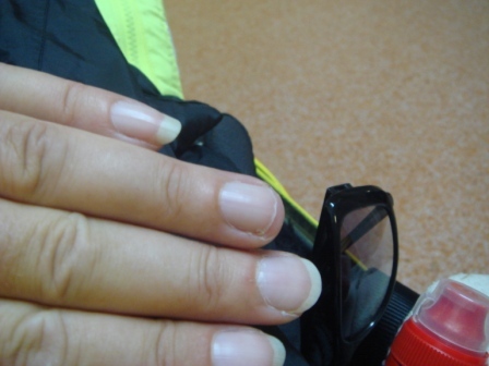 01 My broken fingernail